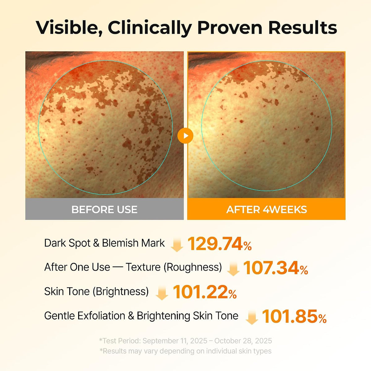 Kojic Acid Turmeric TX Toner Pad