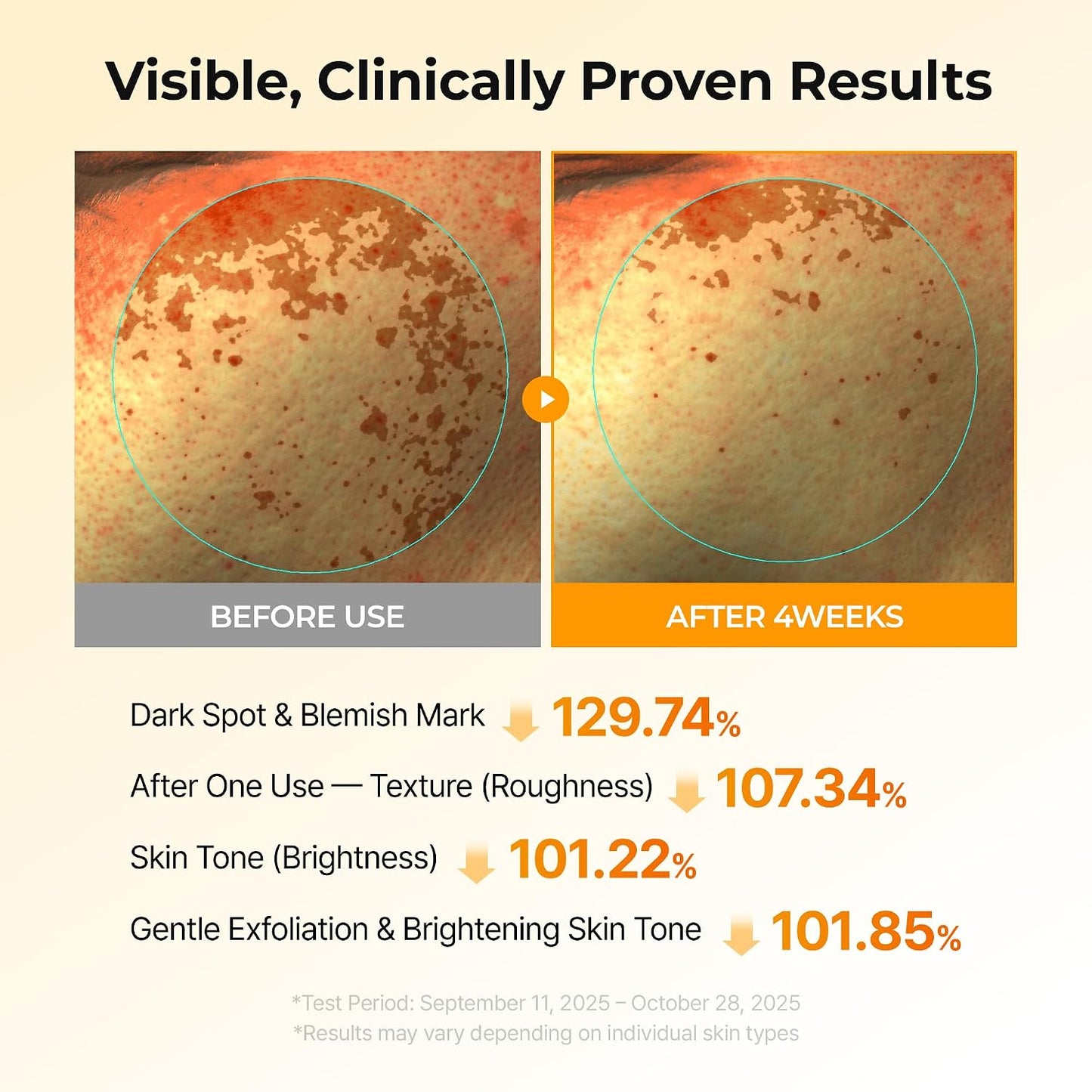 Kojic Acid Turmeric TX Toner Pad